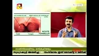 Tonsil and Adenoid! Can we avoid their surgery? Dr. Vinod B. Nair