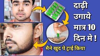 घनी दाढ़ी और मूंछ उगाने का सबसे असरदार उपाए | Beard Growth Tips | Dadhi Kaise Badhaye