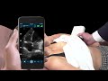 Cardiac Scan by Nathaniel Reisinger | Ultrasound Explained | Clarius Portable Ultrasound