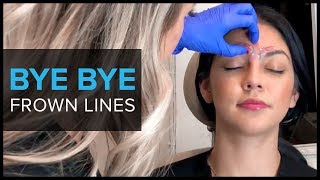 Why We Use BOTOX For Frown Lines