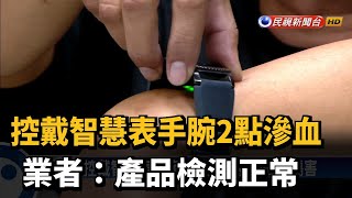 控戴智慧表手腕2點滲血 業者:產品檢測正常－民視新聞