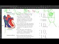 16 demystifying physiological splitting of s2 heart sound explained physiologicalsplitting