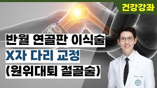 반월연골판이식술 전 X자 다리의 교정 (원위대퇴 절골술)