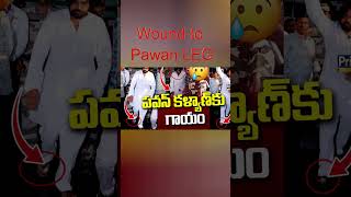 పవన్ కళ్యాణ్ కాలికి గాయం | ఎవరు కొట్టారు? | ఎందుకు సైలెన్స్? | Pawan Kalyan | Ramcharan| Boldbalu TV