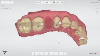 3Shape 트리오스 – 브릿지 워크플로 - 3Shape TRIOS - Bridge Workflow