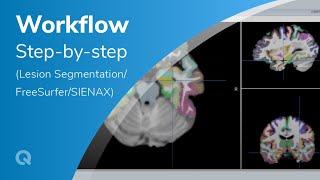 Workflow (Lesion Segmentation/FreeSurfer/SIENAX) - Step-by-step presentation