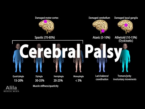 What causes cerebral palsy during pregnancy?