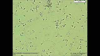 Sperm Motility Assessment exercise 1