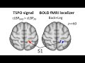 Neuroimmune signatures in chronic low back pain subtypes