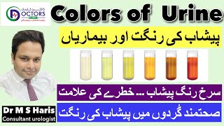 What does color of urine means || Urine colors and Diseases || foamy urine|| Red urine|| Dark Urine