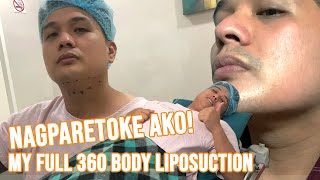 NAGPARETOKE AKO! My Full Body 360 Liposuction Journey