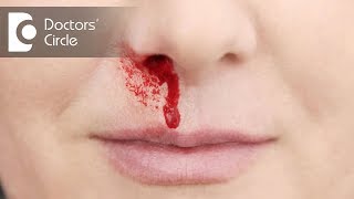 What causes bloody nose while sleeping? - Dr. Lakshmi Ponnathpur