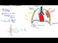 Pneumothorax