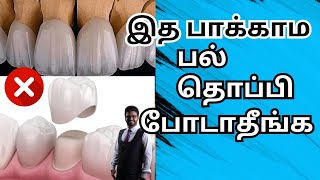 பல் தொப்பி போடாதீங்க!! Don't crown your teeth before watching this!!