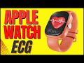 Apple Watch ECG:  What you need to know.