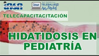 Hidatidosis en Pediatría - Telecapacitación INSN