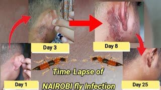 Time-lapse of Nairobi fly infection|Reacting to my time-lapse video| nairobi  infection in siliguri