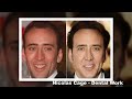 Celebrities Plastic Surgery Transformations -  40 Stars Before After Plastic Surgery