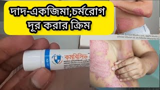 কমবিসিড ক্রিম এর কাজ কি? Combicid Cream এর কাজ ও ব্যাবহারবিধি  | বিভিন্ন চর্মরোগ দূর করার ক্রিম