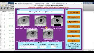 Matlab Code for Iris Recognition Using Image Processing Matlab Project Code Final Year Project