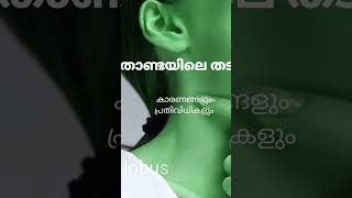 തൊണ്ടയിലെ തടസ്സം