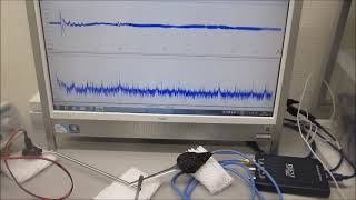 メガヘルツの超音波発振制御プローブ（超音波の送受信テスト）