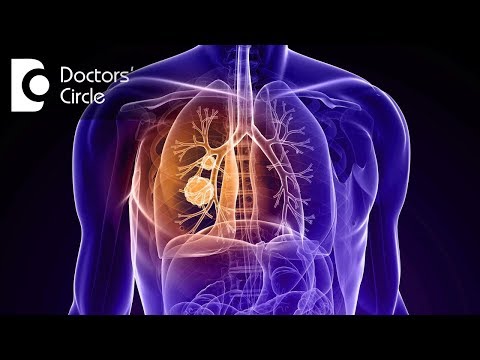How long does it take for a blood clot in the lung to dissolve? - Dr. Shivaraj A L How long does it take for a blood clot in the lung to dissolve? - Dr. Shivaraj A L