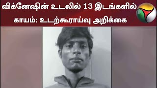 விக்னேஷின் உடலில் 13 இடங்களில் காயம்: உடற்கூராய்வு அறிக்கை