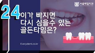 골라보는 치과상식 Q\u0026A 영구치, ○시간 안에만 심으면 된다?