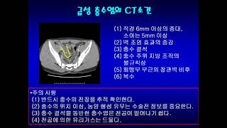 복부 응급 CT 증례(33)