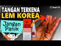 An easy way to deal with fingers exposed to Korean glue / G glue / power glue / super glue