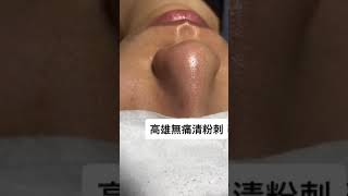 Best Satifying videos for Relaxation with Rat Tana Acne Spa