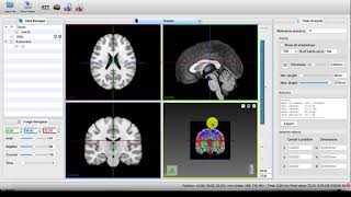 MI-Brain - 2D/3D views layout