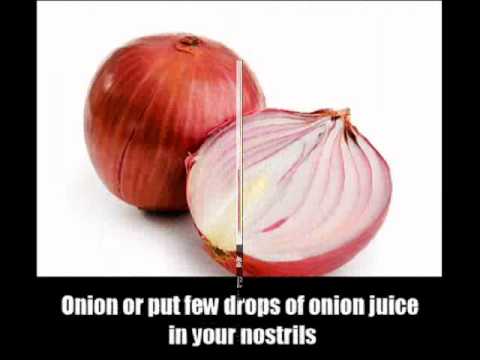 How To Treat Nose Bleeds With Natural Home Remedies How To Treat Nose Bleeds With Natural Home Remedies
