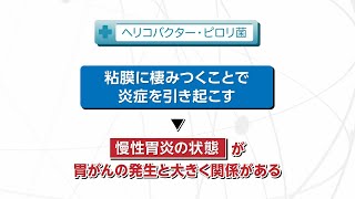 【知りたい！がん検診】Vol. 561回「胃がん検診について」