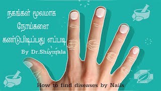 Did you know that your fingernails can provide clues to your overall health By #Dr.ShyamalaOfficial