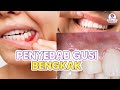 APA SAJA SIH PENYEBAB GUSI BENGKAK?