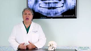 Oral Biopsies with Dr. Kevin Payton | Oral Facial Reconstruction