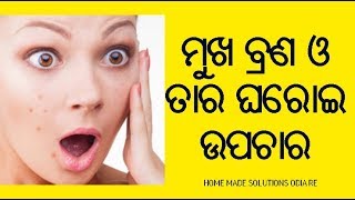 HOW TO REMOVE PIMPLES OVERNIGHT IN ODIA | Pimples Treatment | ମୁଖ ବ୍ରଣ ର ଚମତ୍କାର ପ୍ରତିକାର