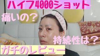 【アラフォー】エステサロンでハイフ4000ショットやってきた ガチレビュー