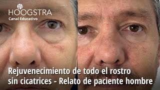 Rejuvenecimiento de todo el rostro sin cicatrices - Relato de paciente hombre - 25025