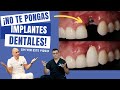 ¡No te pongas un Implante Dental sin ver este video!