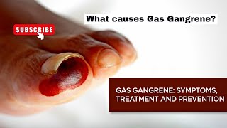 What is a Gas Gangrene? Symptoms