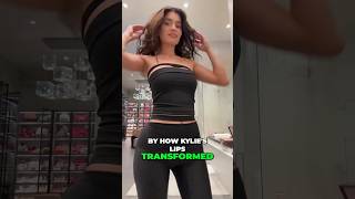 Kylie Jenner's Lip Transformation: The Truth About Her Full Lips Revealed