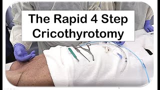 The Rapid 4 Step Cricothyrotomy Technique