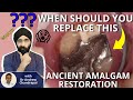 When Should I Replace This Ancient Amalgam Restoration - PDP083