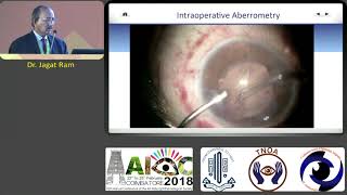 AIOC2018 - IC027 - Topic - IntraOperative Aberrometry. By Dr.Jagat Ram