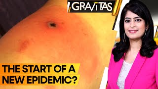 Gravitas | Alaskapox: The new killer virus claims its first victim