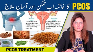 What is the Treatment of PCOS Ka Elaj Urdu Hindi | Causes of PCOS |  Polycystic Ovary Syndrome