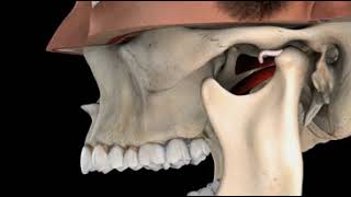 TMJ, without Reduction